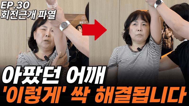 런트쌤 유튜브 사례 영상 썸네일 — EP.30 회전근개 파열 (장면 2)